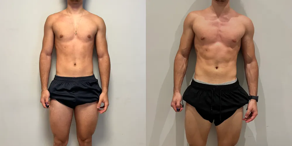 Antes e depois 01